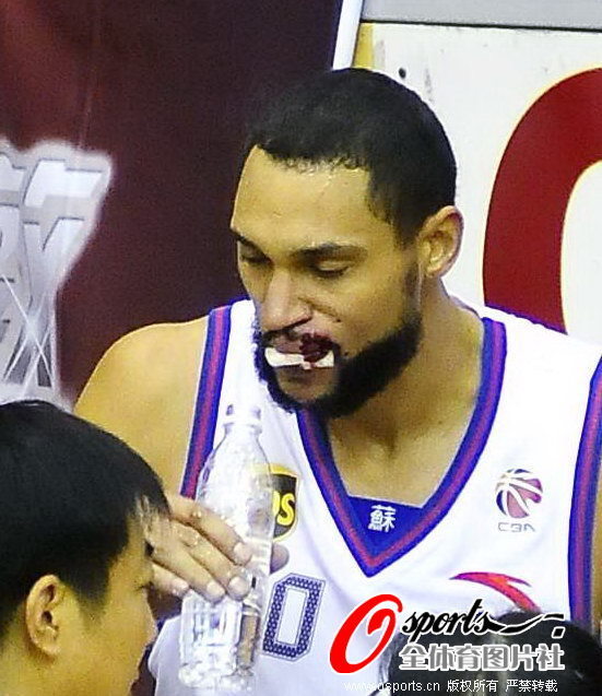 少踢1人平阿森納！馬雷斯卡：11對11，我們比他們強得多